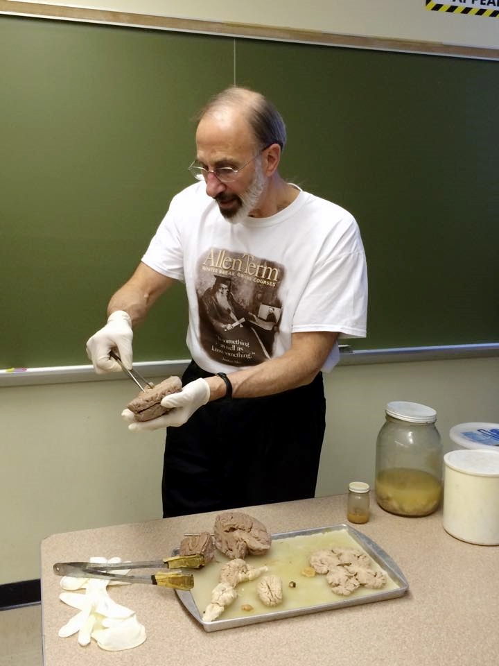 A psychology professor wearing gloves demonstrates a human brain dissection in front of a classroom chalkboard.